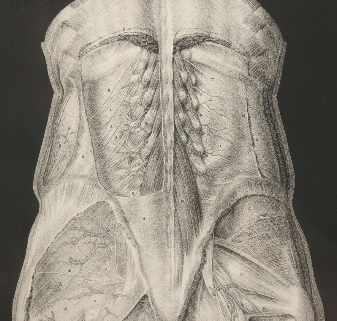 Lot 060 - Antique Black And White Anatomical Print After N. H. Jacob Showing A Dissection Of The Human Back Side, In Modern Frame, 14-7/8" x 19"
