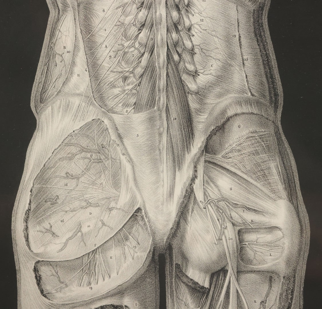 Lot 060 - Antique Black And White Anatomical Print After N. H. Jacob Showing A Dissection Of The Human Back Side, In Modern Frame, 14-7/8" x 19"