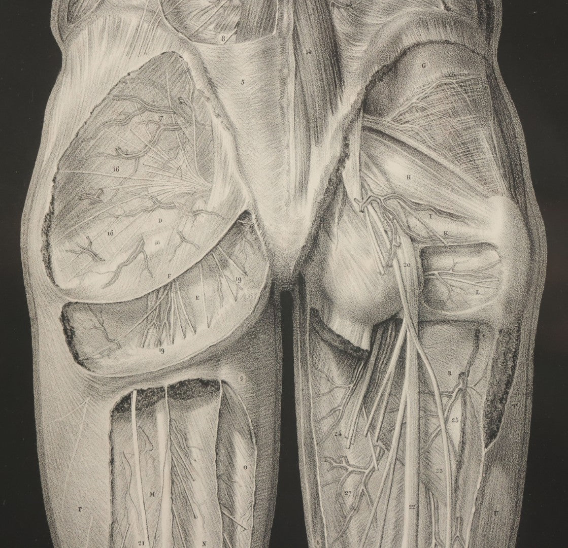 Lot 060 - Antique Black And White Anatomical Print After N. H. Jacob Showing A Dissection Of The Human Back Side, In Modern Frame, 14-7/8" x 19"