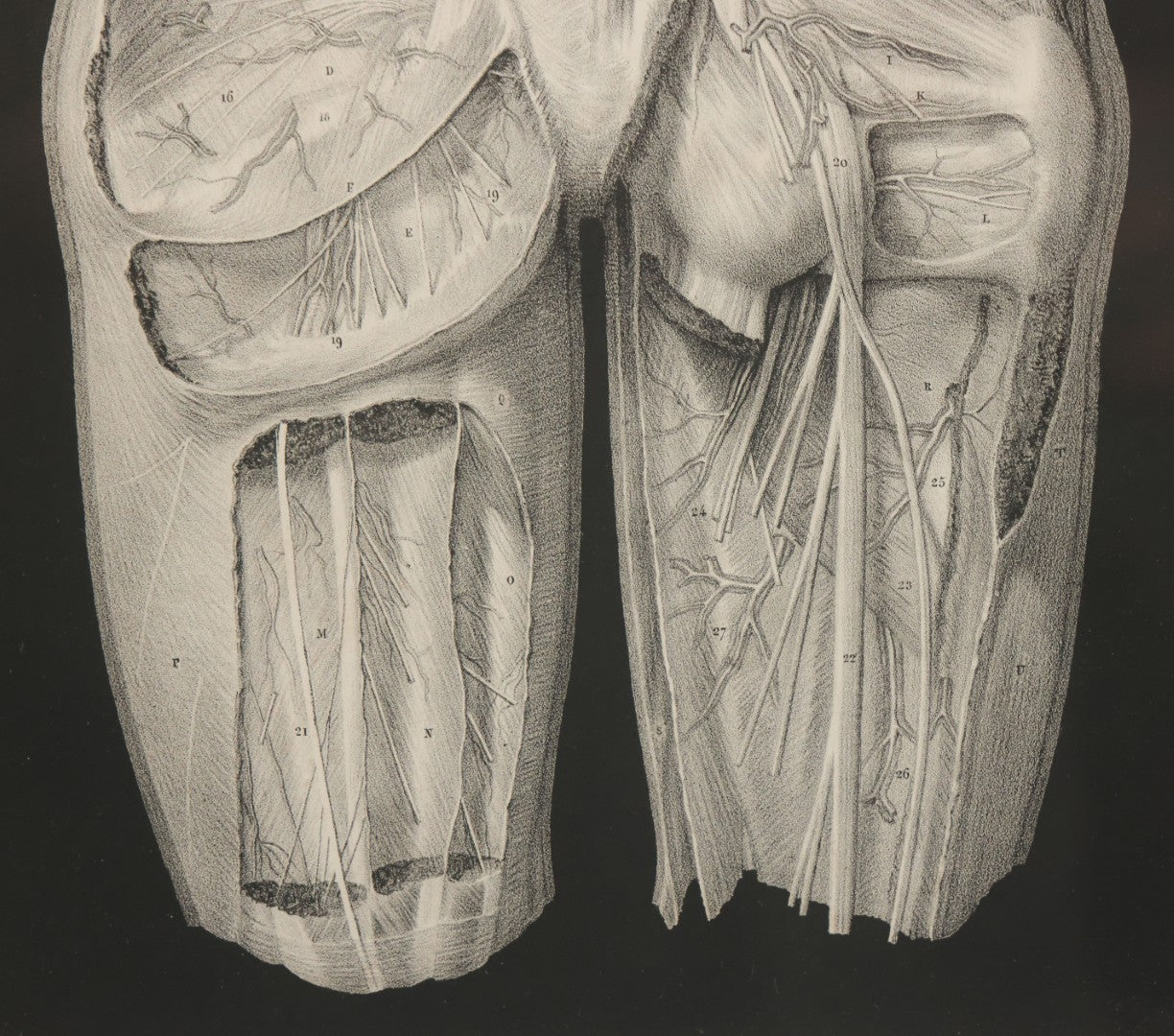 Lot 060 - Antique Black And White Anatomical Print After N. H. Jacob Showing A Dissection Of The Human Back Side, In Modern Frame, 14-7/8" x 19"