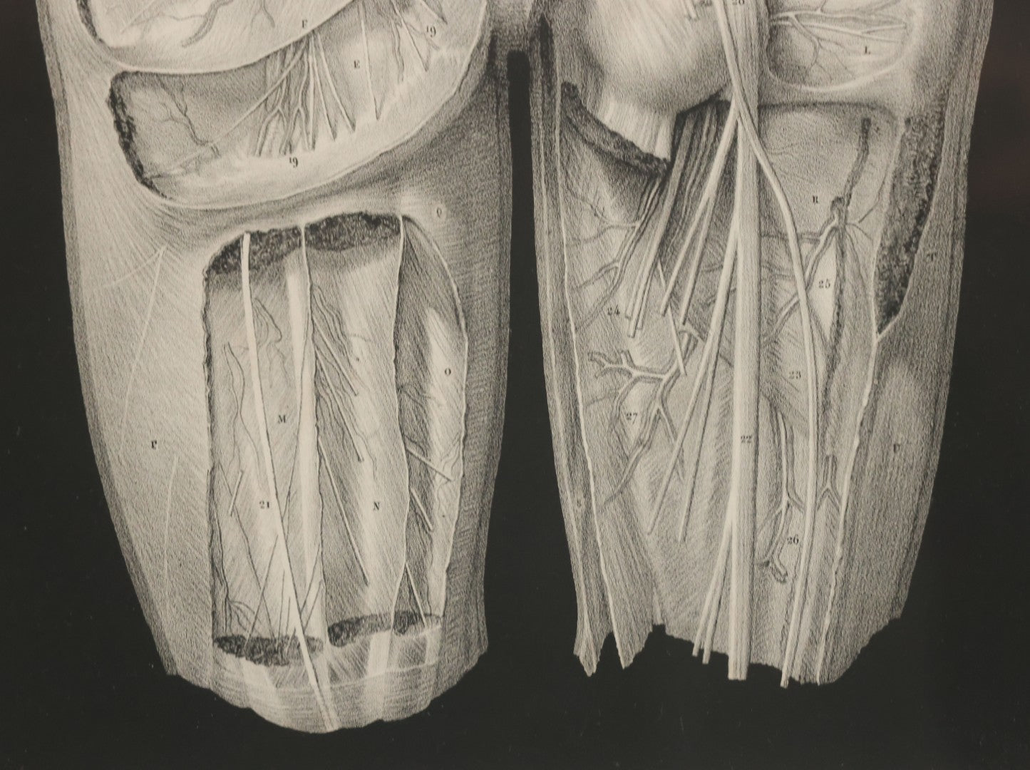 Lot 060 - Antique Black And White Anatomical Print After N. H. Jacob Showing A Dissection Of The Human Back Side, In Modern Frame, 14-7/8" x 19"