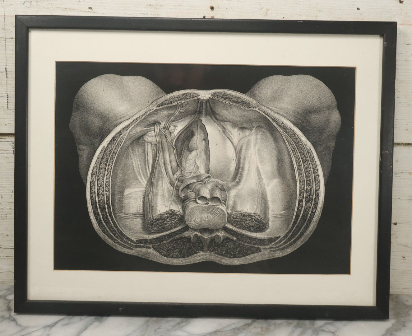 Lot 061 - Antique Black And White Anatomical Print After N. H. Jacob Showing A Dissection Of The Human Pelvis, In Modern Frame, 19" x 14-7/8"