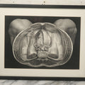 Lot 061 - Antique Black And White Anatomical Print After N. H. Jacob Showing A Dissection Of The Human Pelvis, In Modern Frame, 19" x 14-7/8"