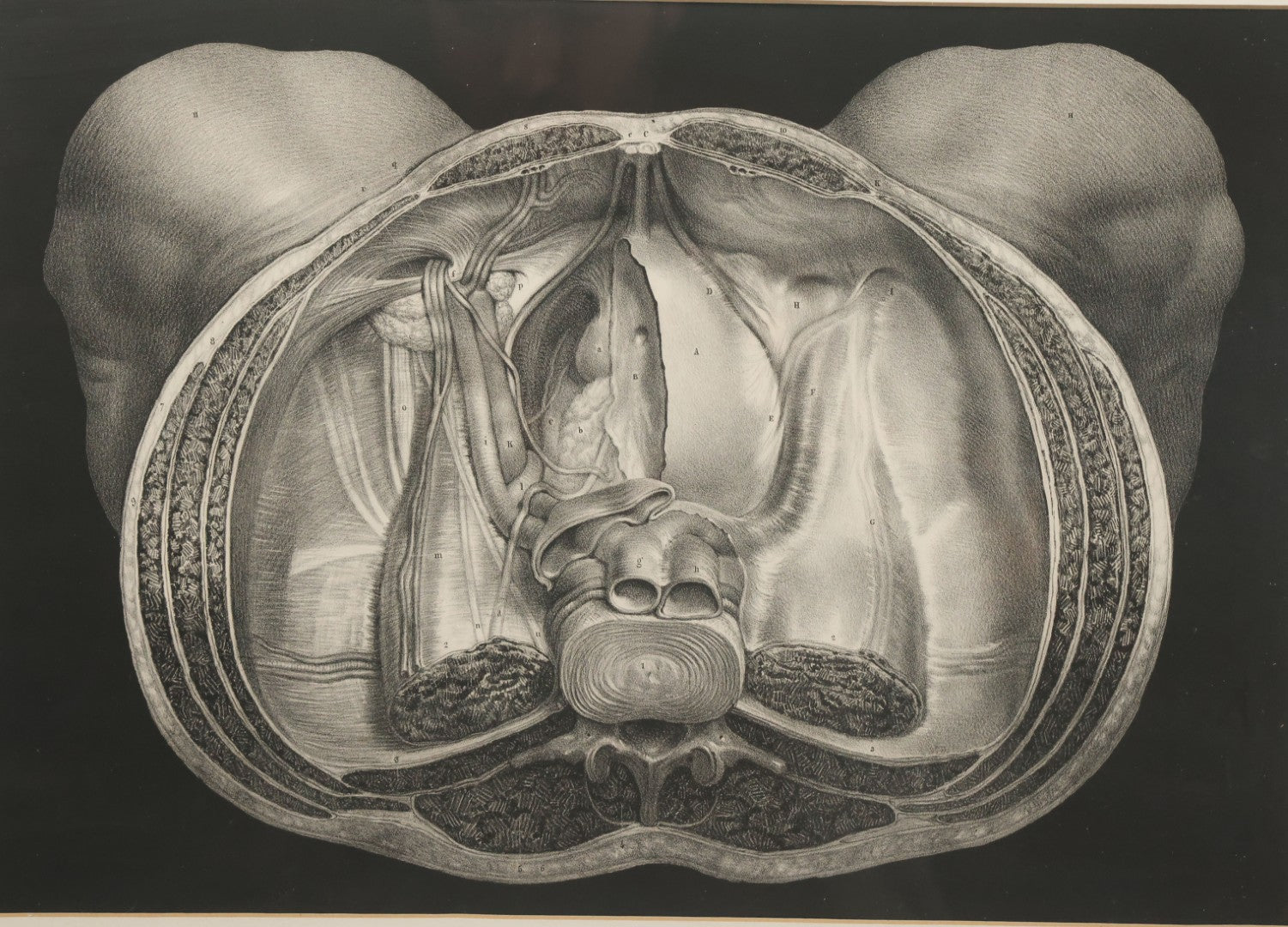 Lot 061 - Antique Black And White Anatomical Print After N. H. Jacob Showing A Dissection Of The Human Pelvis, In Modern Frame, 19" x 14-7/8"