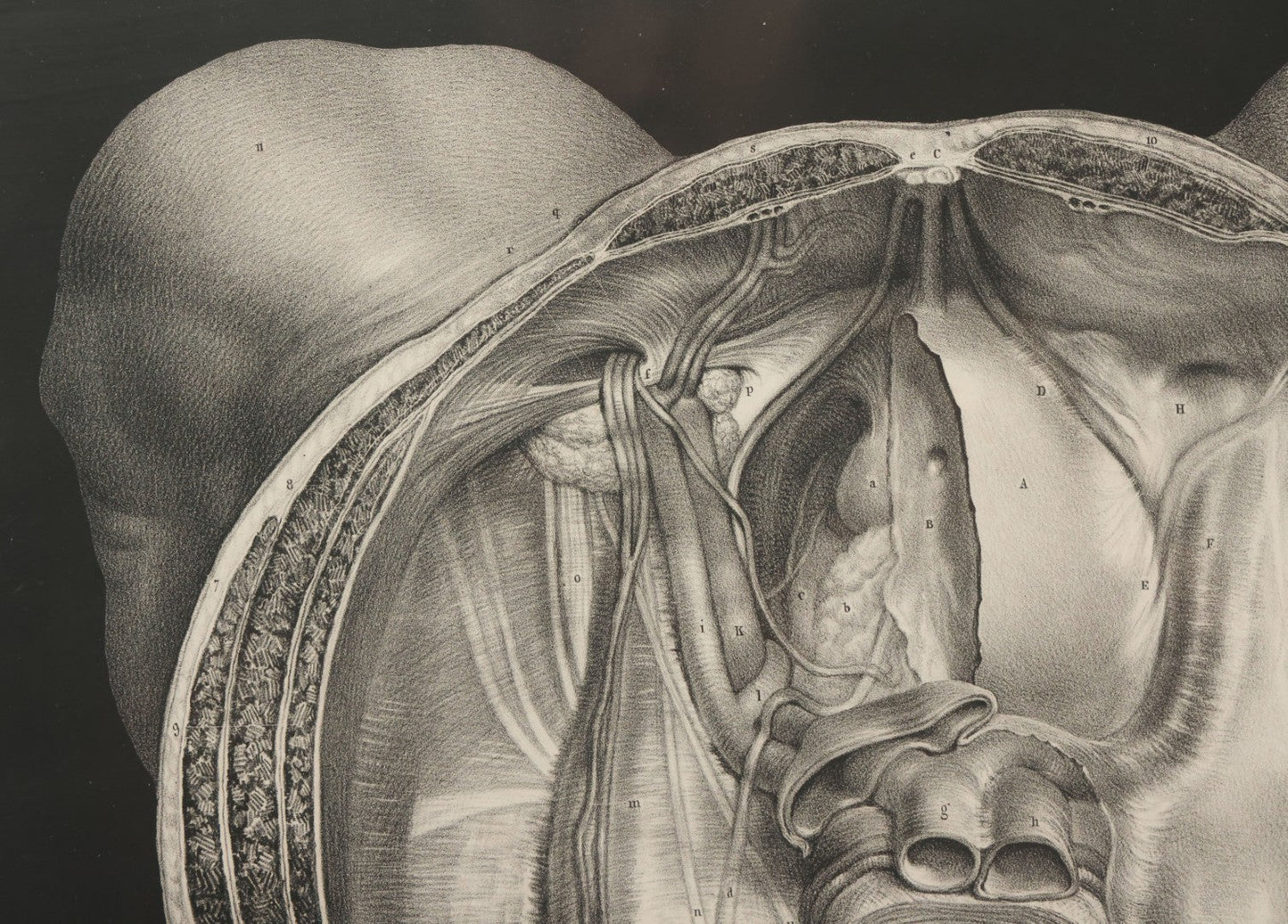 Lot 061 - Antique Black And White Anatomical Print After N. H. Jacob Showing A Dissection Of The Human Pelvis, In Modern Frame, 19" x 14-7/8"