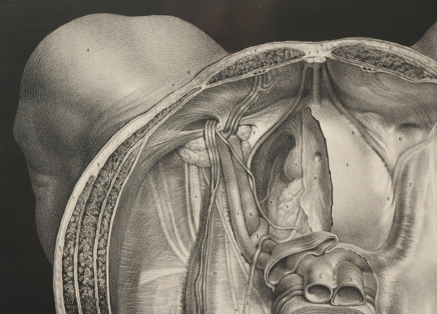 Lot 061 - Antique Black And White Anatomical Print After N. H. Jacob Showing A Dissection Of The Human Pelvis, In Modern Frame, 19" x 14-7/8"