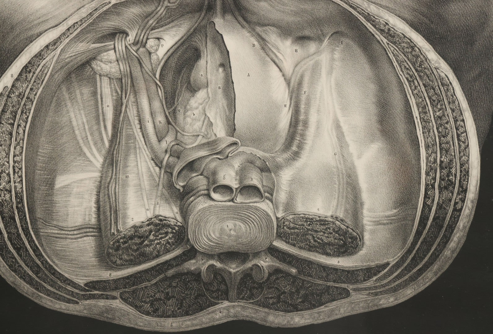 Lot 061 - Antique Black And White Anatomical Print After N. H. Jacob Showing A Dissection Of The Human Pelvis, In Modern Frame, 19" x 14-7/8"