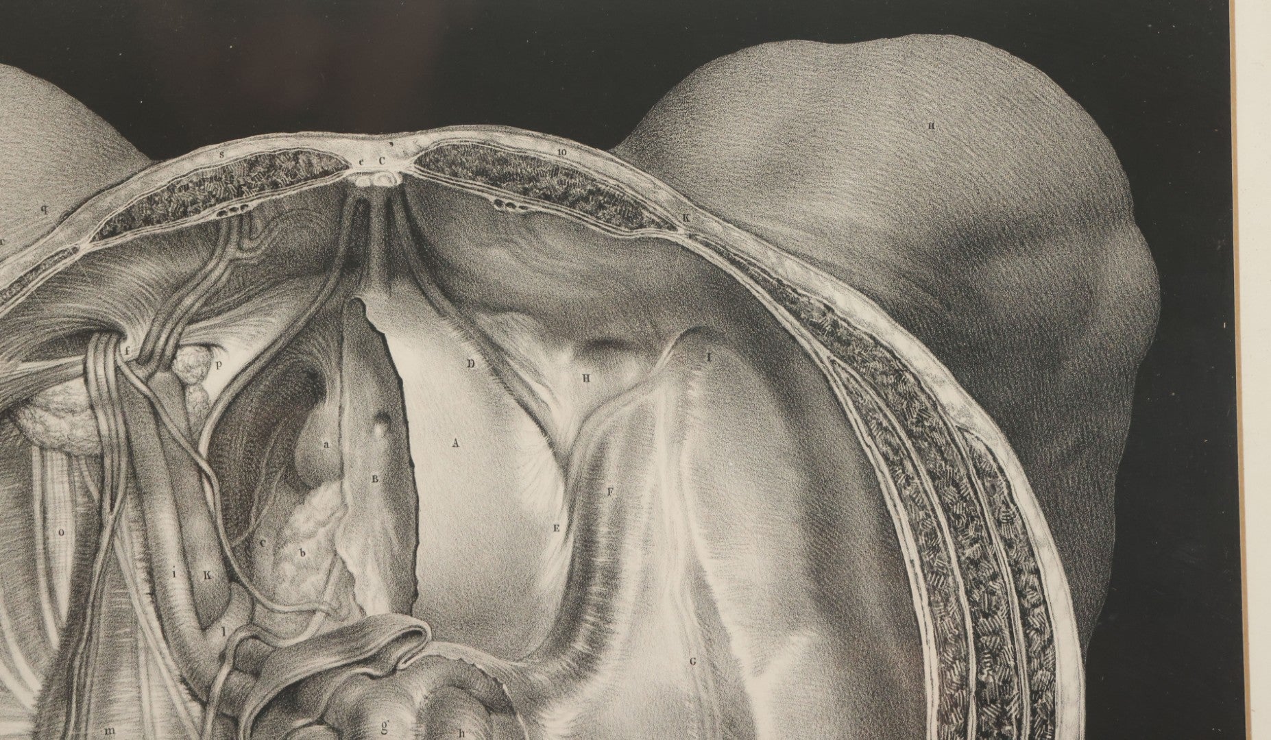 Lot 061 - Antique Black And White Anatomical Print After N. H. Jacob Showing A Dissection Of The Human Pelvis, In Modern Frame, 19" x 14-7/8"