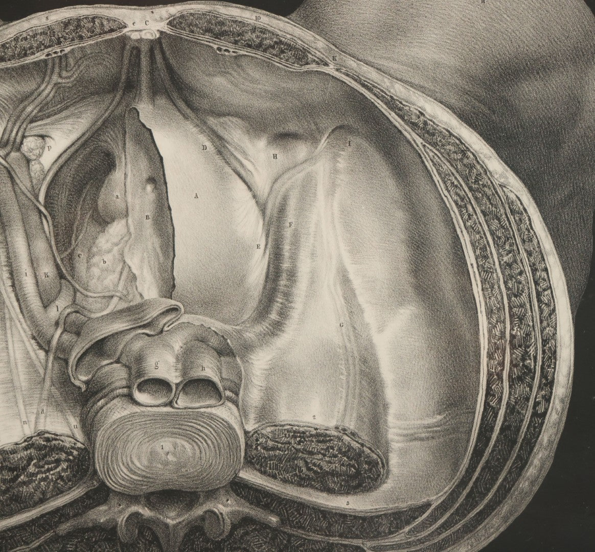 Lot 061 - Antique Black And White Anatomical Print After N. H. Jacob Showing A Dissection Of The Human Pelvis, In Modern Frame, 19" x 14-7/8"