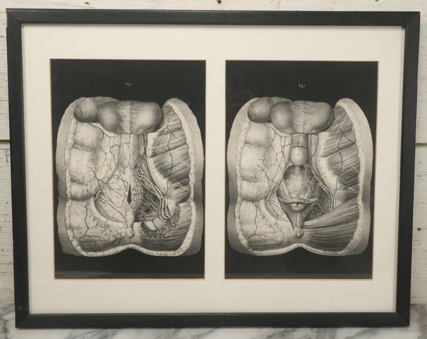 Lot 062 - Antique Black And White Two Part Anatomical Print After N. H. Jacob Showing A Dissection Of The Human Abdomen, In Modern Frame, 19" x 14-7/8"