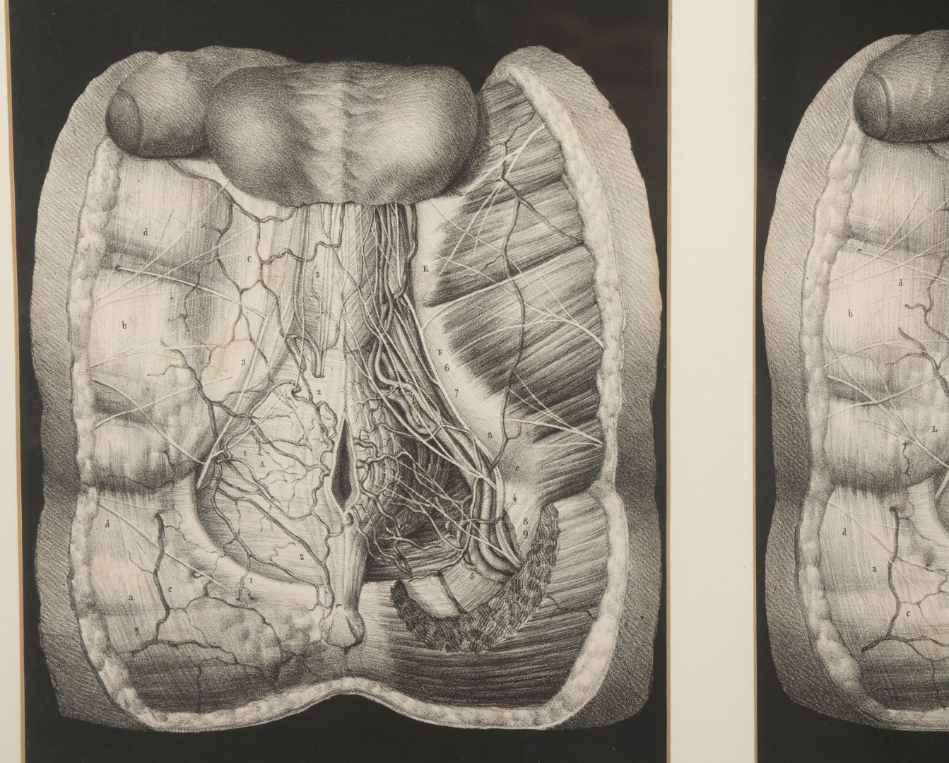 Lot 062 - Antique Black And White Two Part Anatomical Print After N. H. Jacob Showing A Dissection Of The Human Abdomen, In Modern Frame, 19" x 14-7/8"