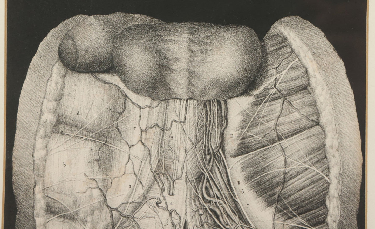 Lot 062 - Antique Black And White Two Part Anatomical Print After N. H. Jacob Showing A Dissection Of The Human Abdomen, In Modern Frame, 19" x 14-7/8"