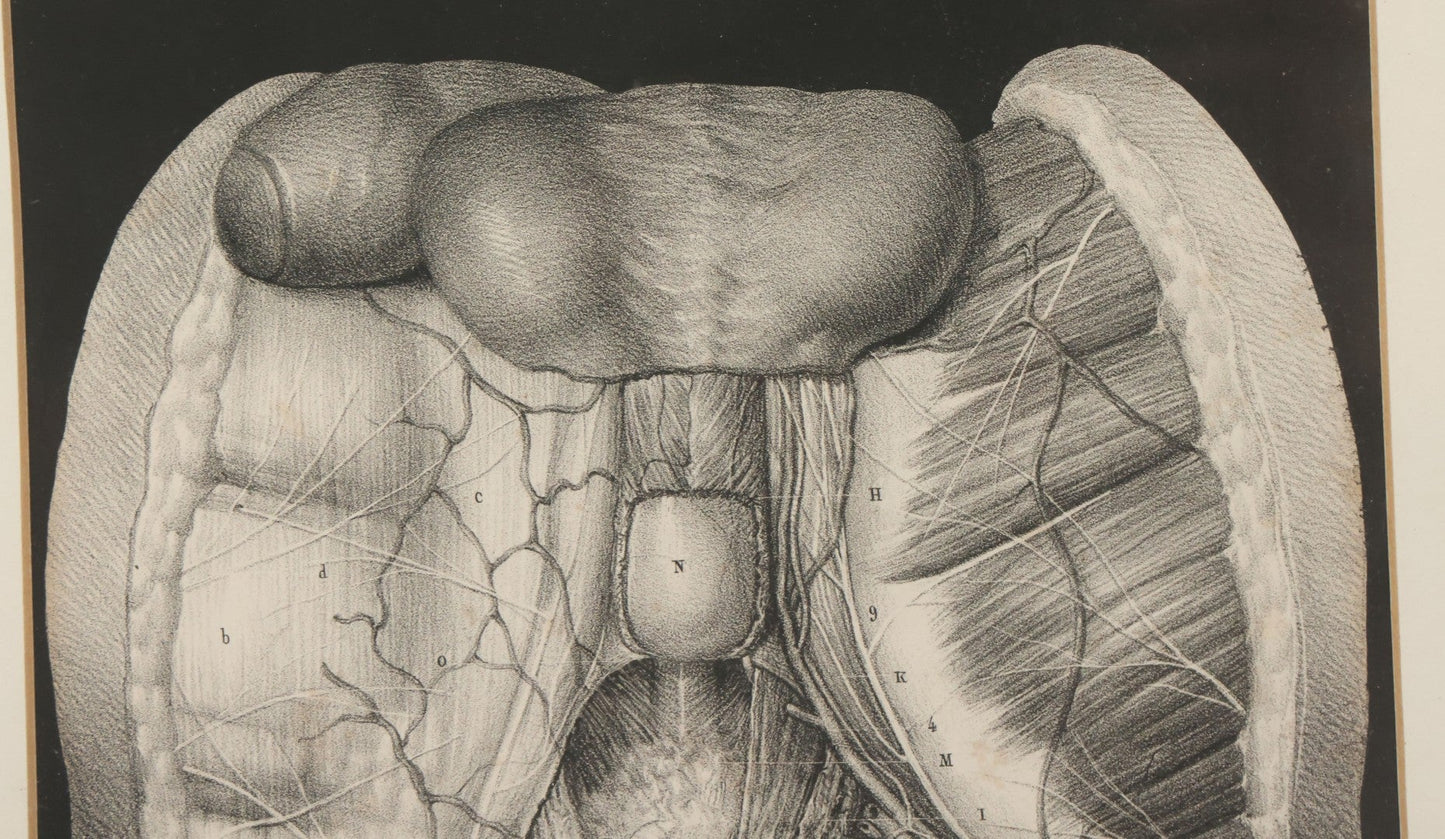 Lot 062 - Antique Black And White Two Part Anatomical Print After N. H. Jacob Showing A Dissection Of The Human Abdomen, In Modern Frame, 19" x 14-7/8"