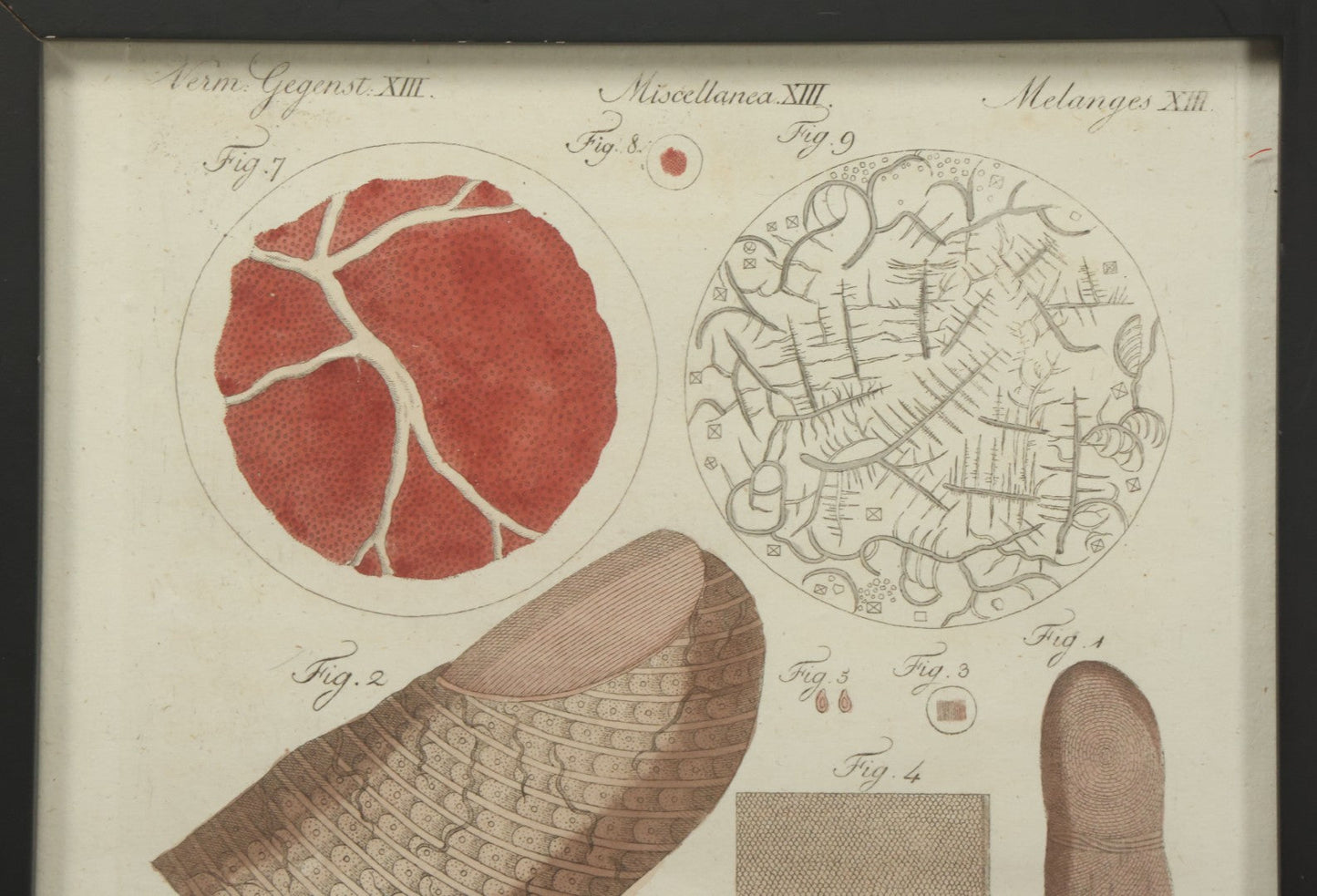 Lot 064 - Antique Late 18th Century Anatomical Book Plate Engraving Print Of The Human Finger, In Modern Frame, 9" x 10-5/8"