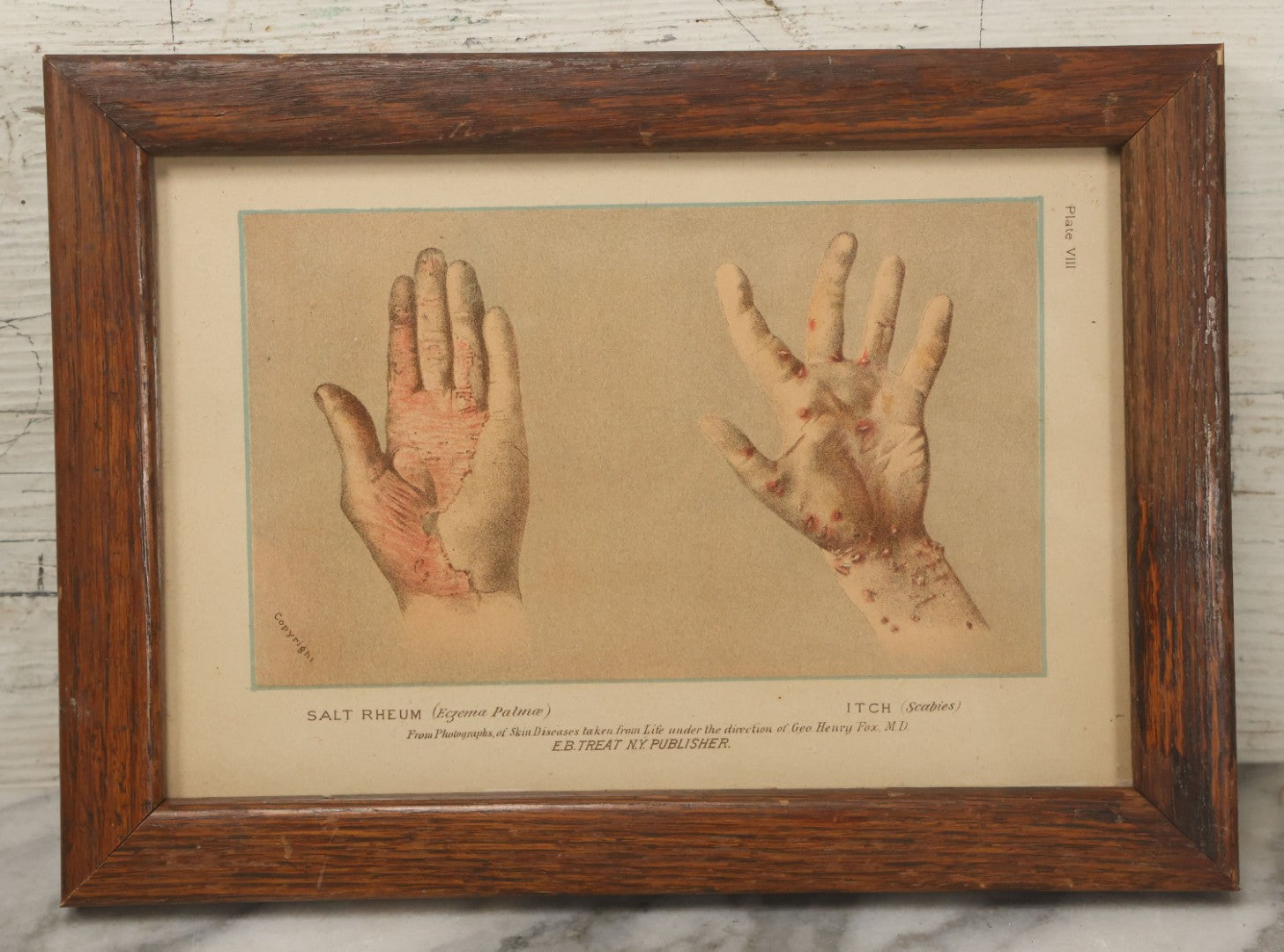 Lot 066 - Antique Skin Condition Medical Print, Salt Rheum & Itch, From Photographs Of Skin Diseases Under The Direction Of George Henry Fox, M.D., Published By E.B. Treat, New York, In Custom Frame, 11" x 8"