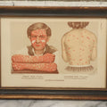 Lot 067 - Antique Skin Condition Medical Print, Small Pox & Chicken Pox, From Photographs Of Skin Diseases Under The Direction Of George Henry Fox, M.D., Published By E.B. Treat, New York, In Custom Frame, 11-1/8" x 8"