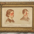 Lot 069 - Antique Skin Condition Medical Print, Erysipelas & Wine Mark, From Photographs Of Skin Diseases Under The Direction Of George Henry Fox, M.D., Published By E.B. Treat, New York, In Custom Frame, 12-1/8" x 9"