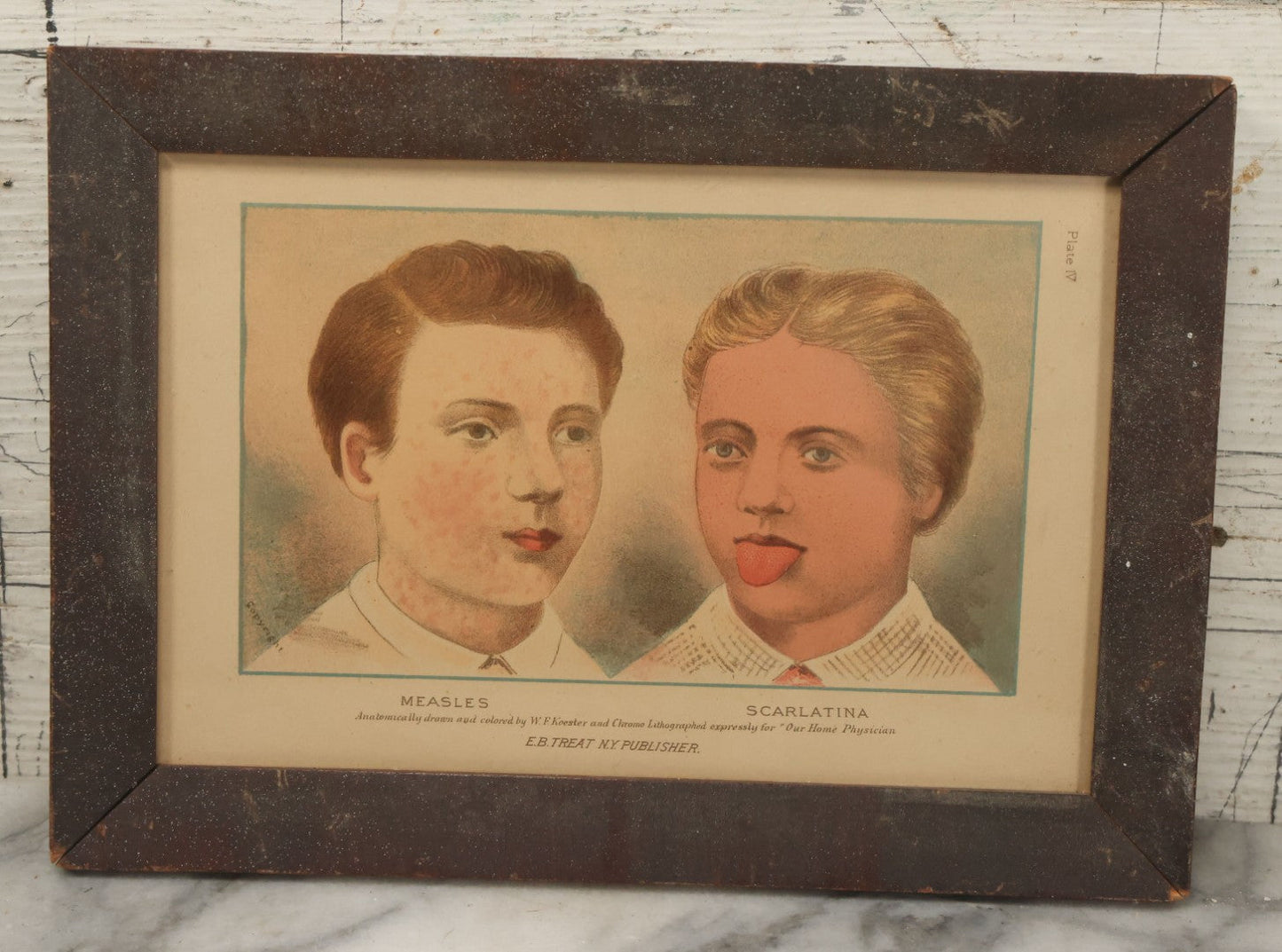 Lot 072 - Antique Skin Condition Medical Print, Measles & Scarlatina, From Photographs Of Skin Diseases Under The Direction Of George Henry Fox, M.D., Published By E.B. Treat, New York, In Custom Frame, 11" x 7-7/8"