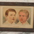 Lot 072 - Antique Skin Condition Medical Print, Measles & Scarlatina, From Photographs Of Skin Diseases Under The Direction Of George Henry Fox, M.D., Published By E.B. Treat, New York, In Custom Frame, 11" x 7-7/8"