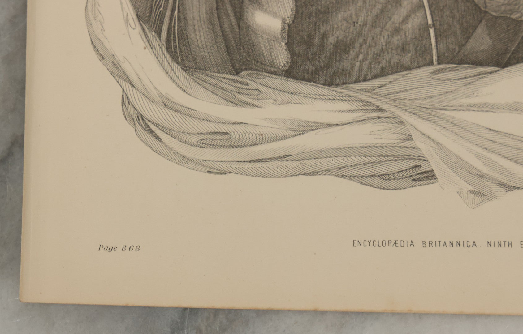 Lot 110 - Grouping Of 10+ Antique Black And White Medical Ephemera Book Plate Prints From Encyclopedia Britannica, 9th Edition, B Y W. & A.K. Johnston