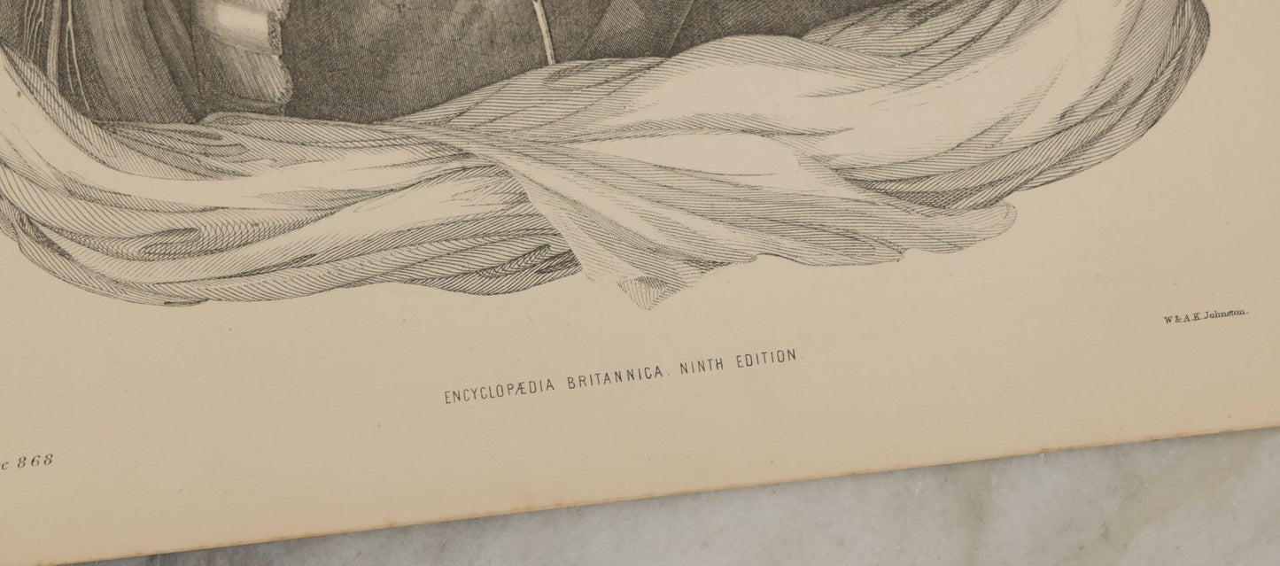 Lot 110 - Grouping Of 10+ Antique Black And White Medical Ephemera Book Plate Prints From Encyclopedia Britannica, 9th Edition, B Y W. & A.K. Johnston