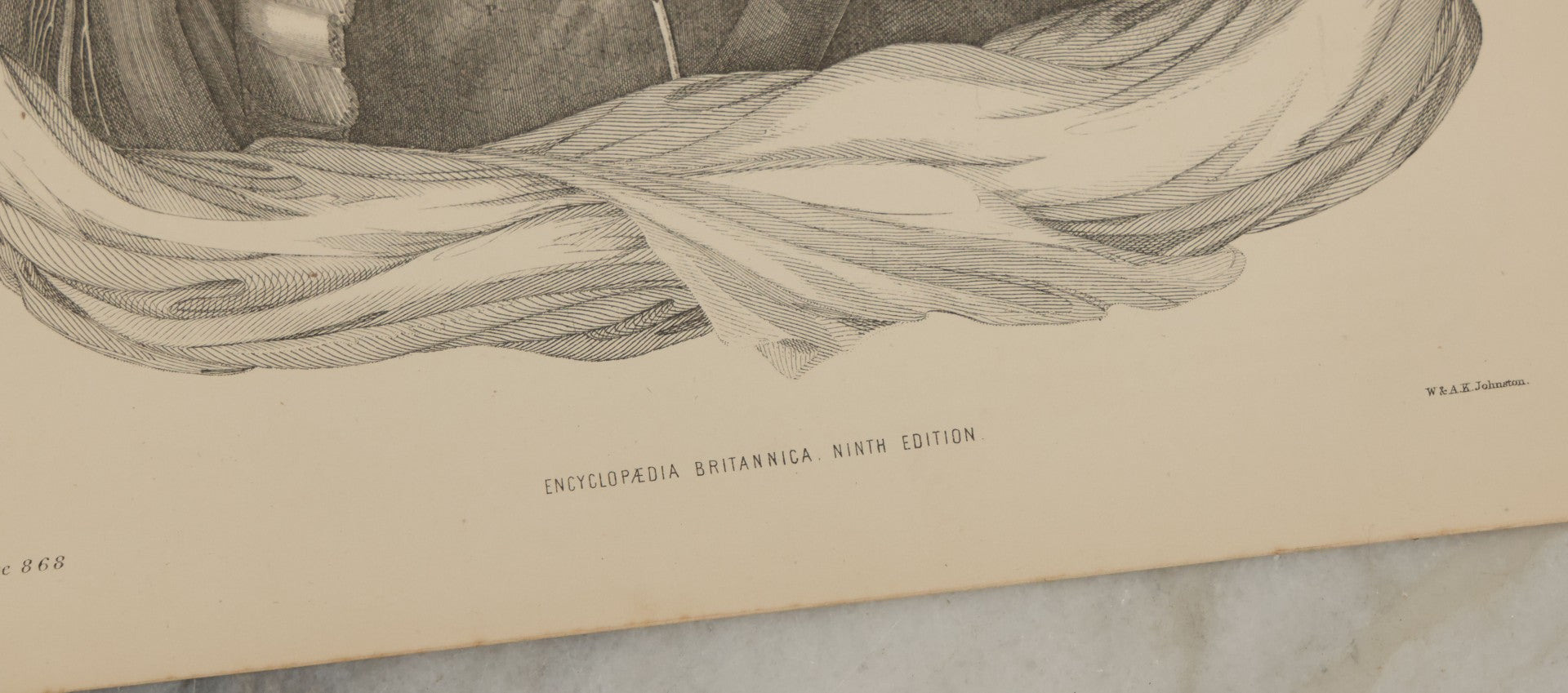 Lot 110 - Grouping Of 10+ Antique Black And White Medical Ephemera Book Plate Prints From Encyclopedia Britannica, 9th Edition, B Y W. & A.K. Johnston