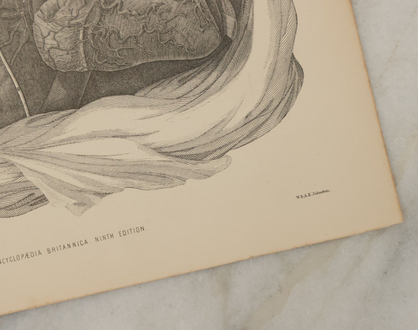 Lot 110 - Grouping Of 10+ Antique Black And White Medical Ephemera Book Plate Prints From Encyclopedia Britannica, 9th Edition, B Y W. & A.K. Johnston