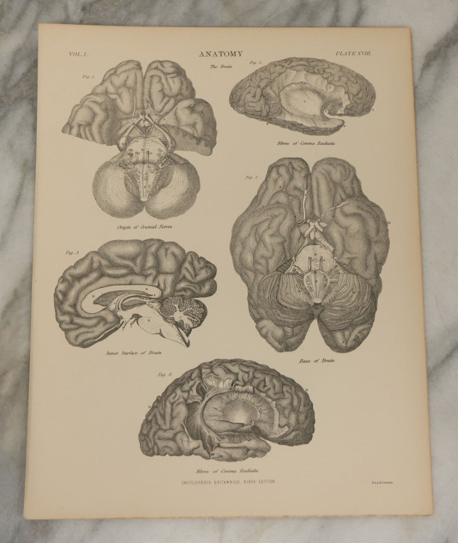 Lot 110 - Grouping Of 10+ Antique Black And White Medical Ephemera Book Plate Prints From Encyclopedia Britannica, 9th Edition, B Y W. & A.K. Johnston