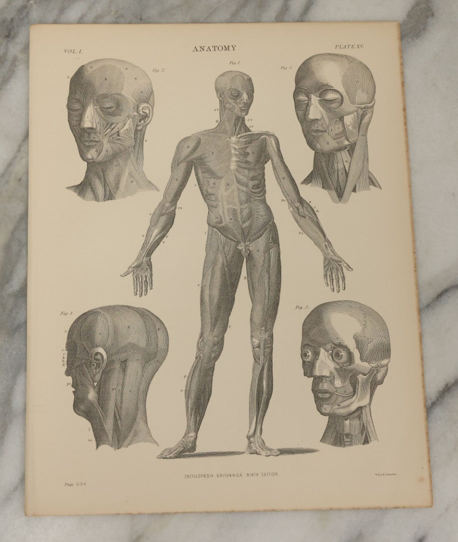 Lot 110 - Grouping Of 10+ Antique Black And White Medical Ephemera Book Plate Prints From Encyclopedia Britannica, 9th Edition, B Y W. & A.K. Johnston