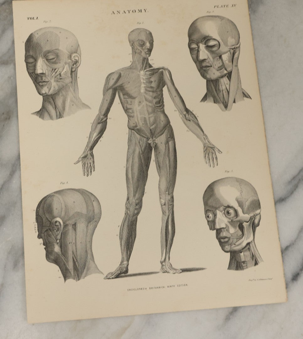 Lot 110 - Grouping Of 10+ Antique Black And White Medical Ephemera Book Plate Prints From Encyclopedia Britannica, 9th Edition, B Y W. & A.K. Johnston