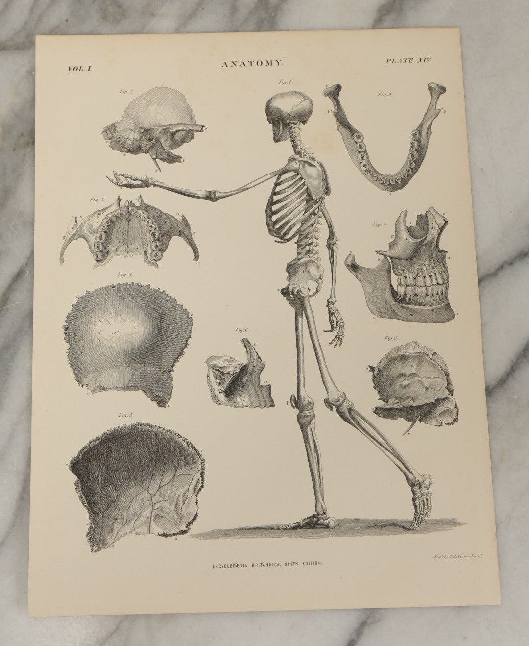 Lot 110 - Grouping Of 10+ Antique Black And White Medical Ephemera Book Plate Prints From Encyclopedia Britannica, 9th Edition, B Y W. & A.K. Johnston