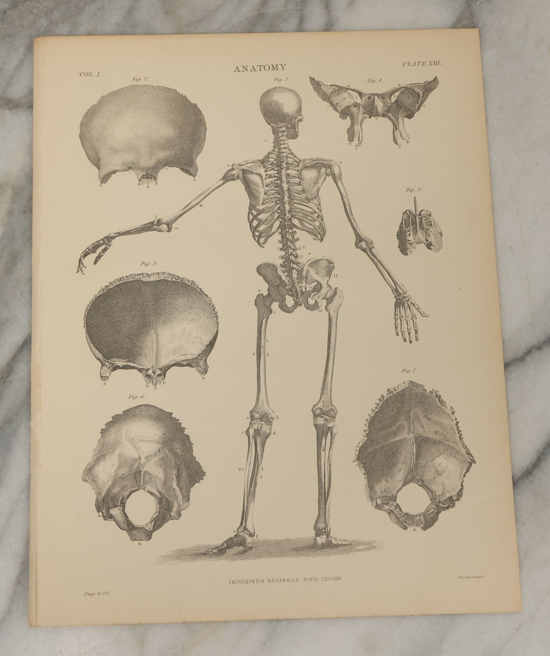 Lot 110 - Grouping Of 10+ Antique Black And White Medical Ephemera Book Plate Prints From Encyclopedia Britannica, 9th Edition, B Y W. & A.K. Johnston