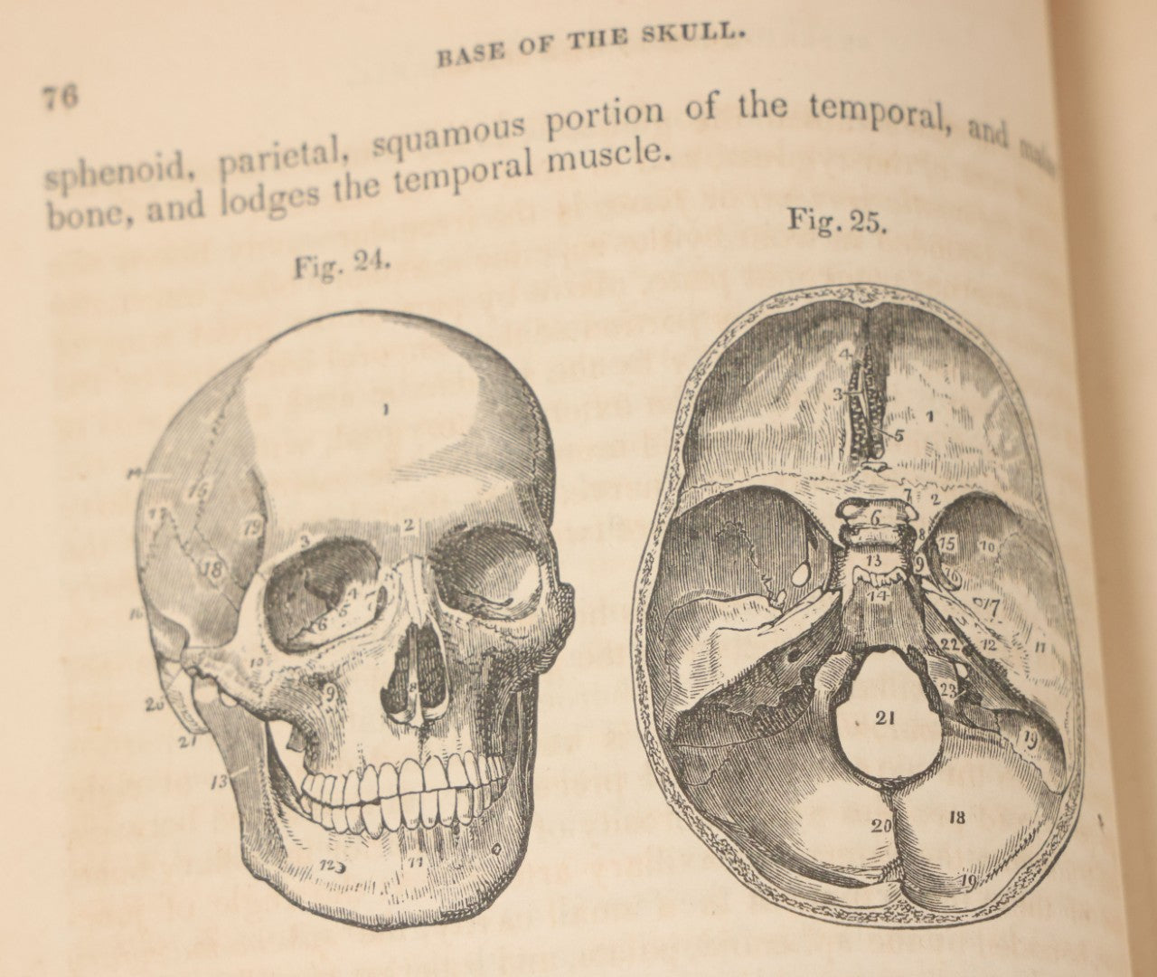 Lot 015 - "Wilson's Anatomy: A System Of Human Anatomy, General And Special" Antique Medical Book By Erasmus Wilson, M.D., Second American Edition, With Over 200 Illustrations By Gilbert, Lea And Blanchard, Publishers, Philadelphia, 1844