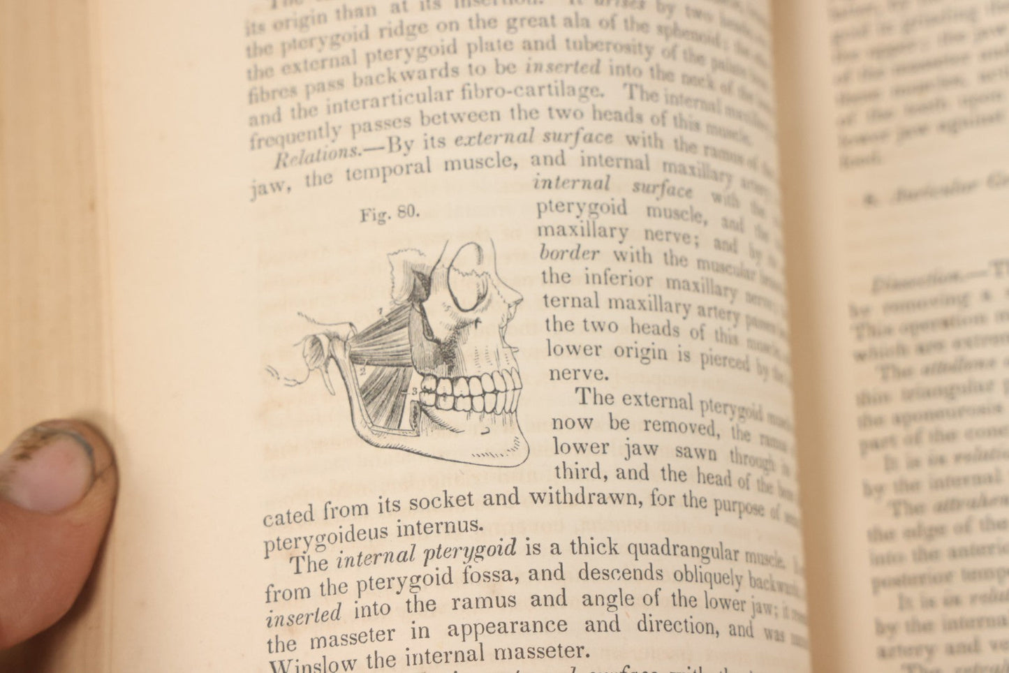Lot 015 - "Wilson's Anatomy: A System Of Human Anatomy, General And Special" Antique Medical Book By Erasmus Wilson, M.D., Second American Edition, With Over 200 Illustrations By Gilbert, Lea And Blanchard, Publishers, Philadelphia, 1844