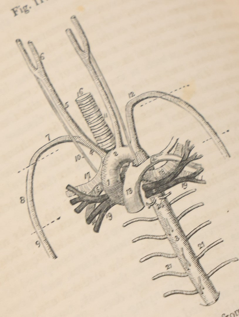 Lot 015 - "Wilson's Anatomy: A System Of Human Anatomy, General And Special" Antique Medical Book By Erasmus Wilson, M.D., Second American Edition, With Over 200 Illustrations By Gilbert, Lea And Blanchard, Publishers, Philadelphia, 1844