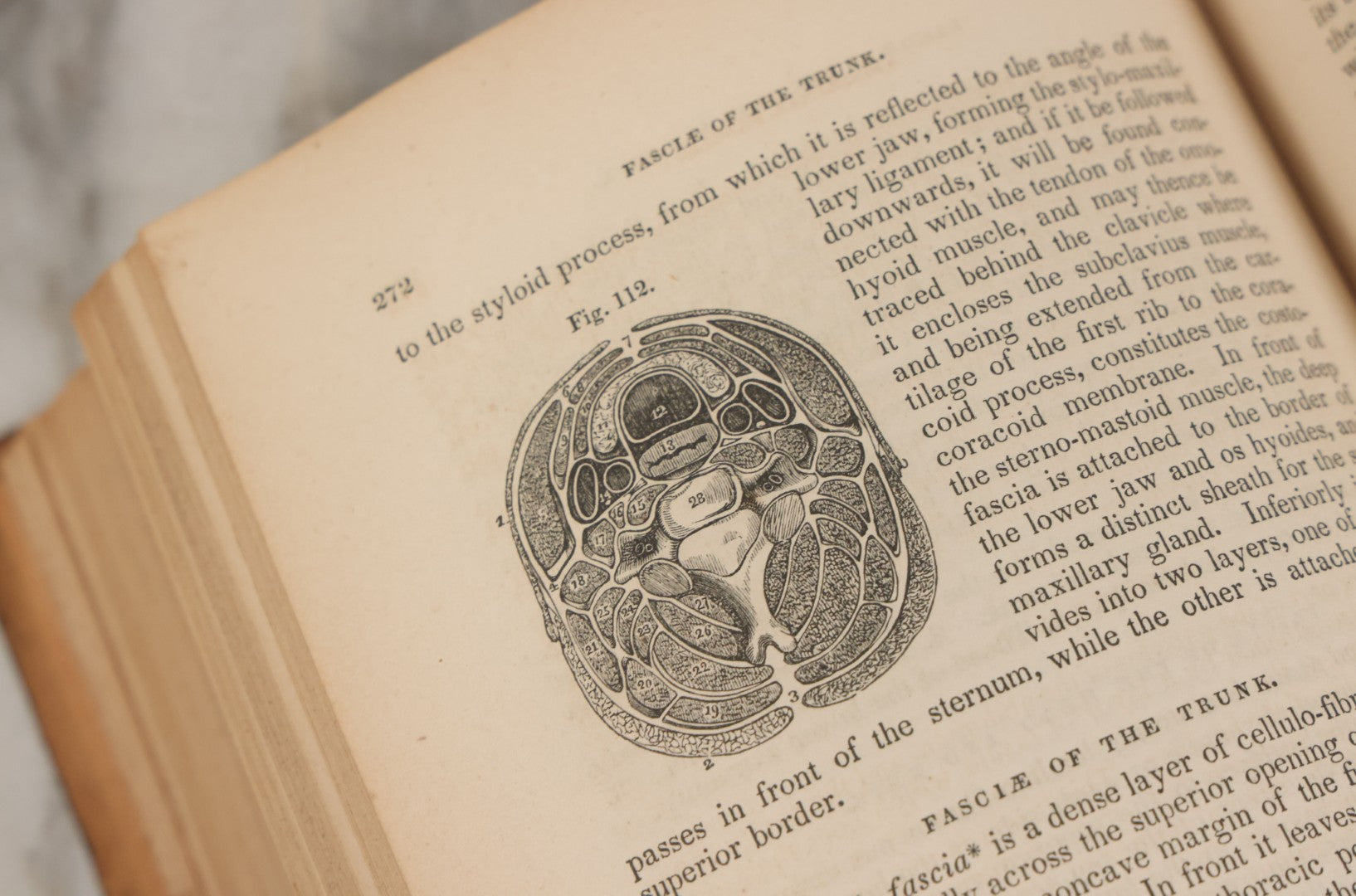 Lot 015 - "Wilson's Anatomy: A System Of Human Anatomy, General And Special" Antique Medical Book By Erasmus Wilson, M.D., Second American Edition, With Over 200 Illustrations By Gilbert, Lea And Blanchard, Publishers, Philadelphia, 1844