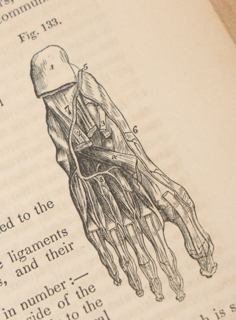 Lot 015 - "Wilson's Anatomy: A System Of Human Anatomy, General And Special" Antique Medical Book By Erasmus Wilson, M.D., Second American Edition, With Over 200 Illustrations By Gilbert, Lea And Blanchard, Publishers, Philadelphia, 1844