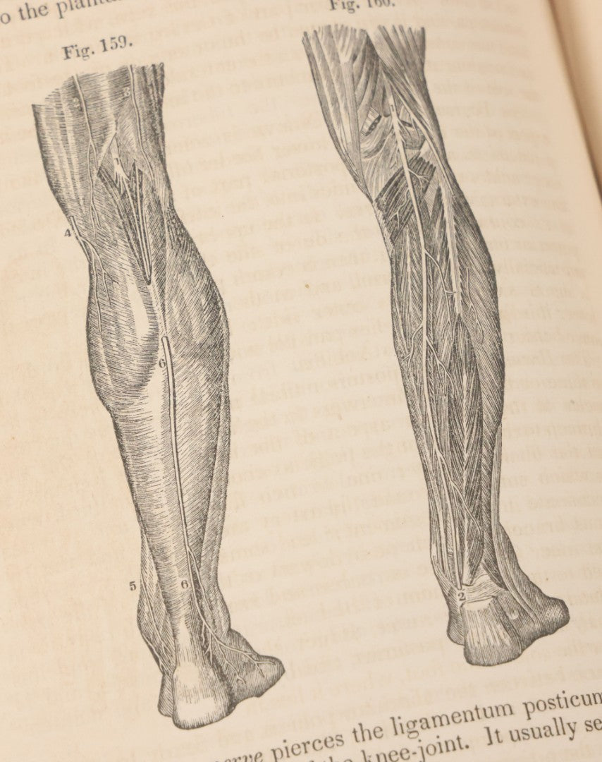 Lot 015 - "Wilson's Anatomy: A System Of Human Anatomy, General And Special" Antique Medical Book By Erasmus Wilson, M.D., Second American Edition, With Over 200 Illustrations By Gilbert, Lea And Blanchard, Publishers, Philadelphia, 1844