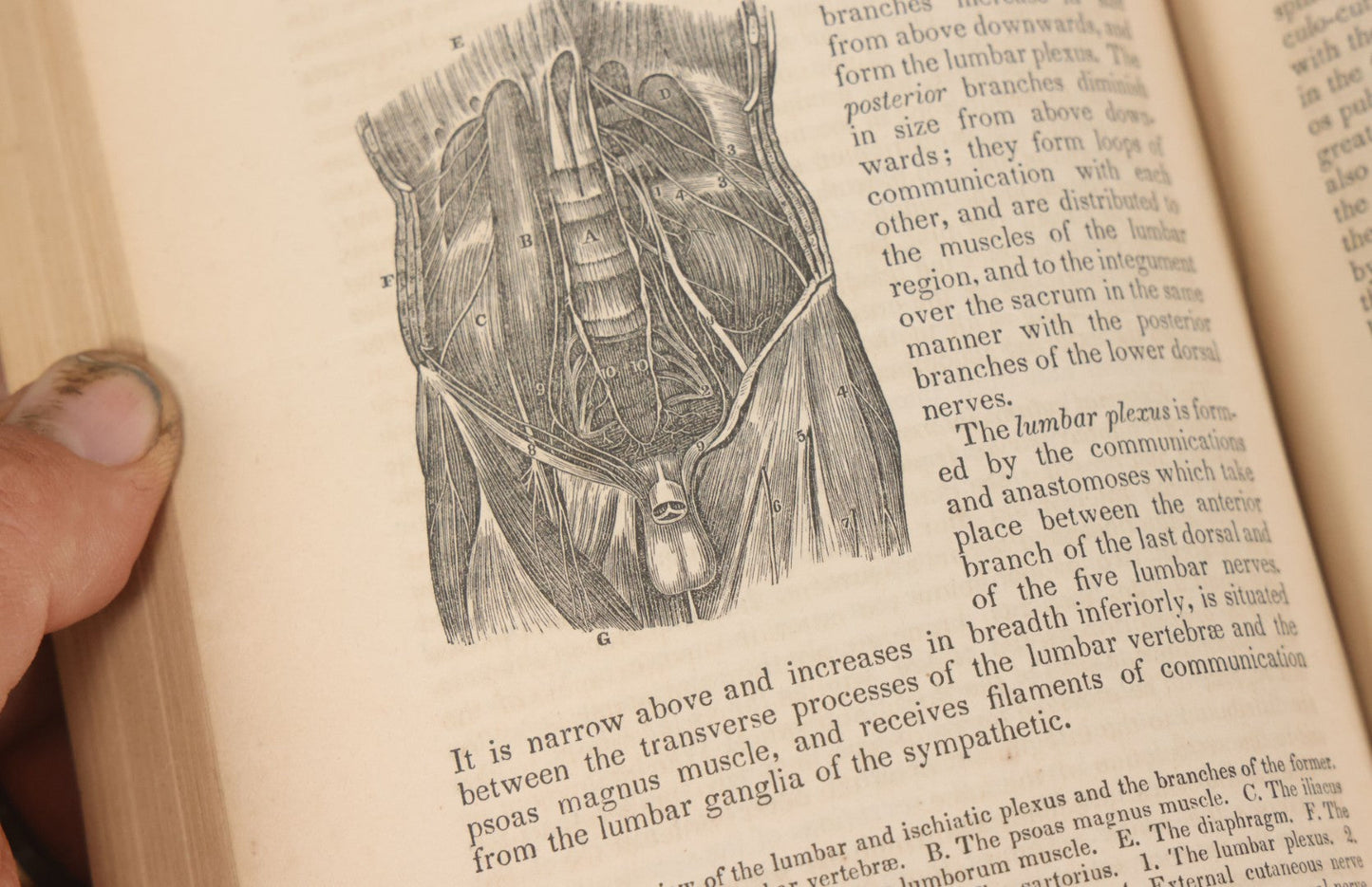 Lot 015 - "Wilson's Anatomy: A System Of Human Anatomy, General And Special" Antique Medical Book By Erasmus Wilson, M.D., Second American Edition, With Over 200 Illustrations By Gilbert, Lea And Blanchard, Publishers, Philadelphia, 1844