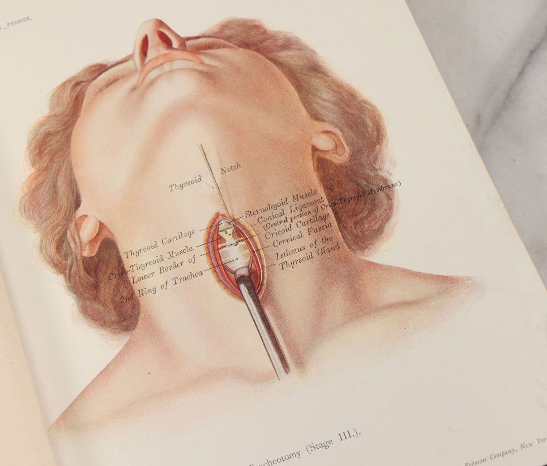 Lot 002 - "Atlas Of Typical Operations In Surgery" Antique Book By Dr. Ph. Bockenheimer & Dr. Fritz Frohse, With 60 Full Color Illustrations By Franz Frohse, English Adaptation By J. Howell Evans, Rebman Company, New York, Publishers, Circa 1900