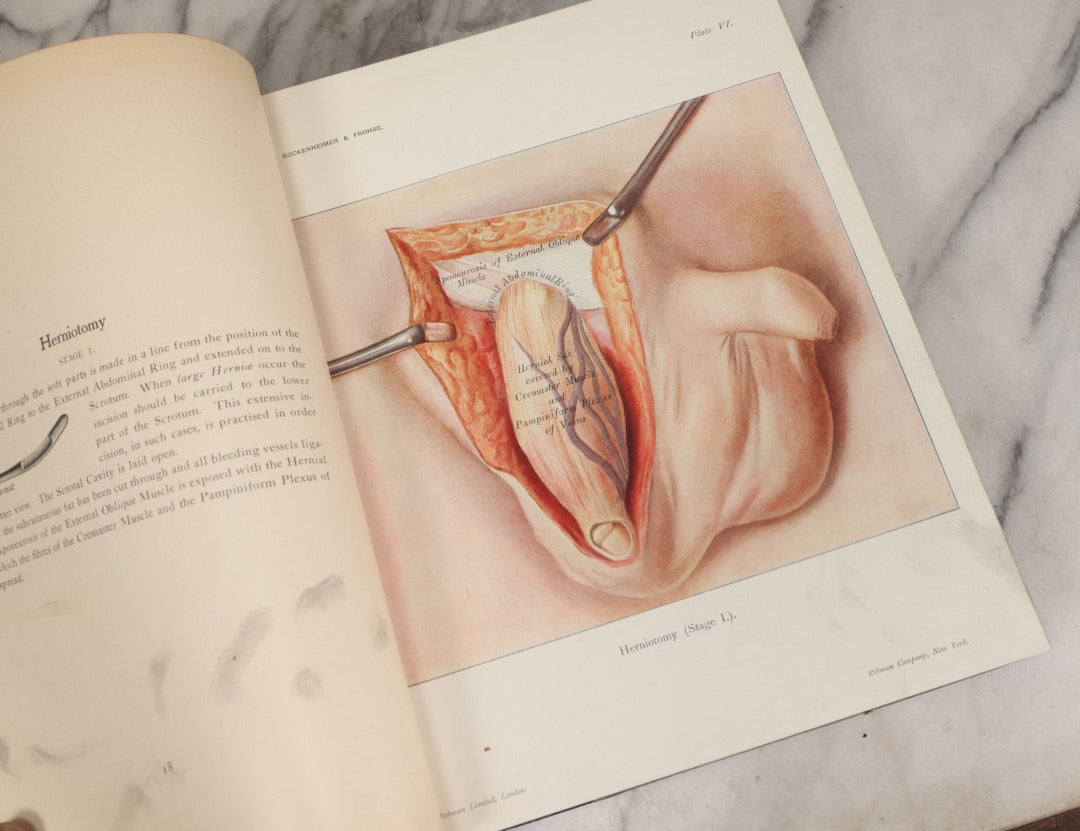 Lot 002 - "Atlas Of Typical Operations In Surgery" Antique Book By Dr. Ph. Bockenheimer & Dr. Fritz Frohse, With 60 Full Color Illustrations By Franz Frohse, English Adaptation By J. Howell Evans, Rebman Company, New York, Publishers, Circa 1900