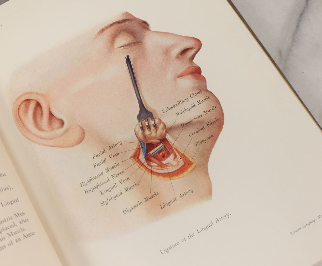 Lot 002 - "Atlas Of Typical Operations In Surgery" Antique Book By Dr. Ph. Bockenheimer & Dr. Fritz Frohse, With 60 Full Color Illustrations By Franz Frohse, English Adaptation By J. Howell Evans, Rebman Company, New York, Publishers, Circa 1900