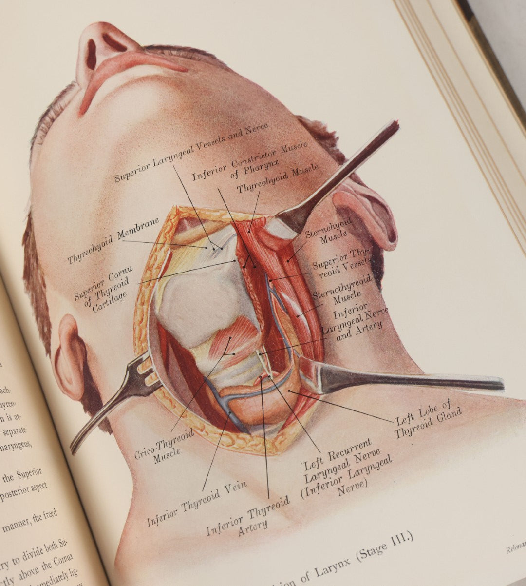 Lot 002 - "Atlas Of Typical Operations In Surgery" Antique Book By Dr. Ph. Bockenheimer & Dr. Fritz Frohse, With 60 Full Color Illustrations By Franz Frohse, English Adaptation By J. Howell Evans, Rebman Company, New York, Publishers, Circa 1900