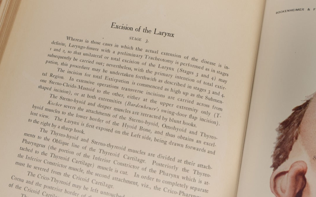 Lot 002 - "Atlas Of Typical Operations In Surgery" Antique Book By Dr. Ph. Bockenheimer & Dr. Fritz Frohse, With 60 Full Color Illustrations By Franz Frohse, English Adaptation By J. Howell Evans, Rebman Company, New York, Publishers, Circa 1900