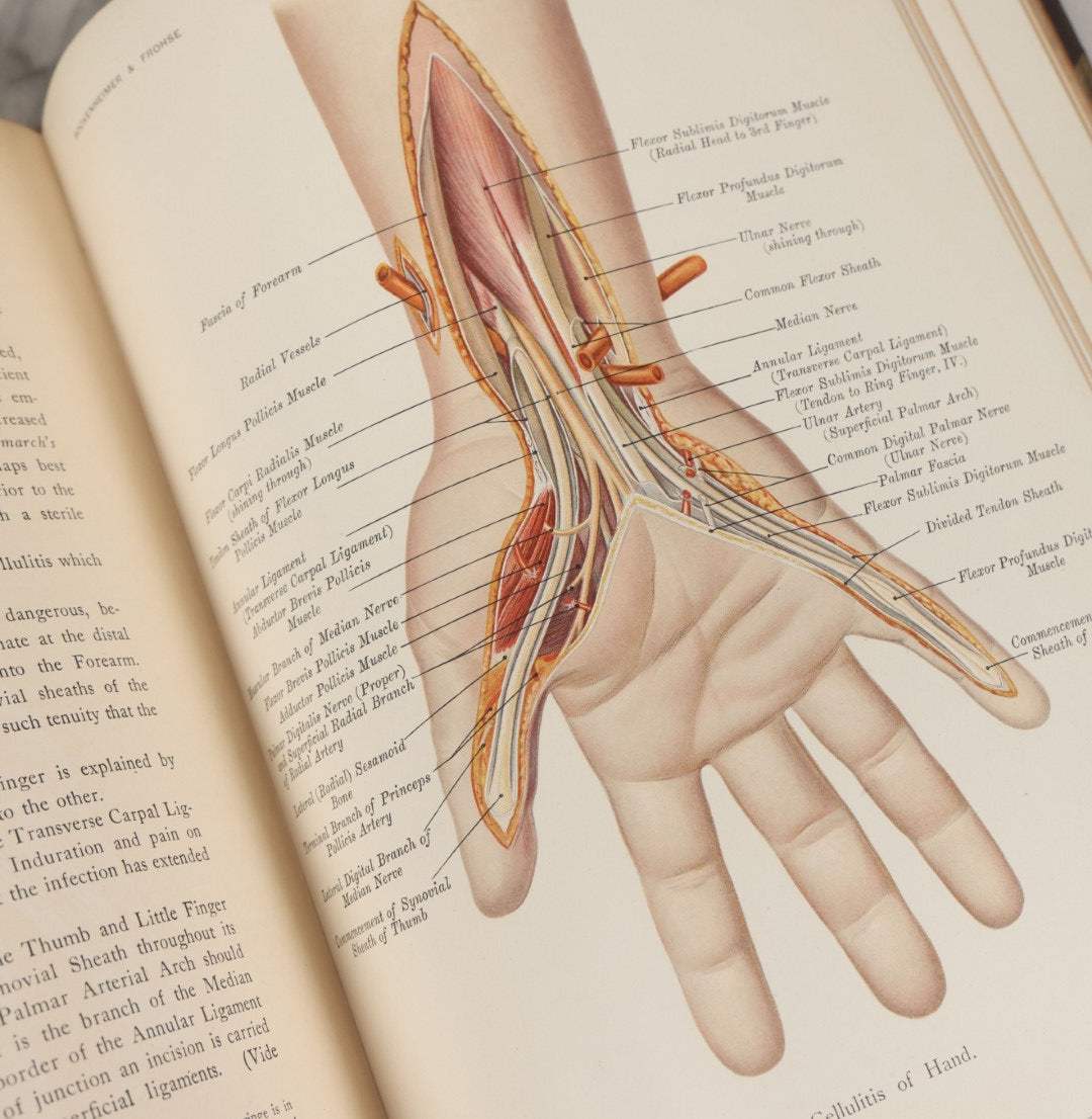 Lot 002 - "Atlas Of Typical Operations In Surgery" Antique Book By Dr. Ph. Bockenheimer & Dr. Fritz Frohse, With 60 Full Color Illustrations By Franz Frohse, English Adaptation By J. Howell Evans, Rebman Company, New York, Publishers, Circa 1900