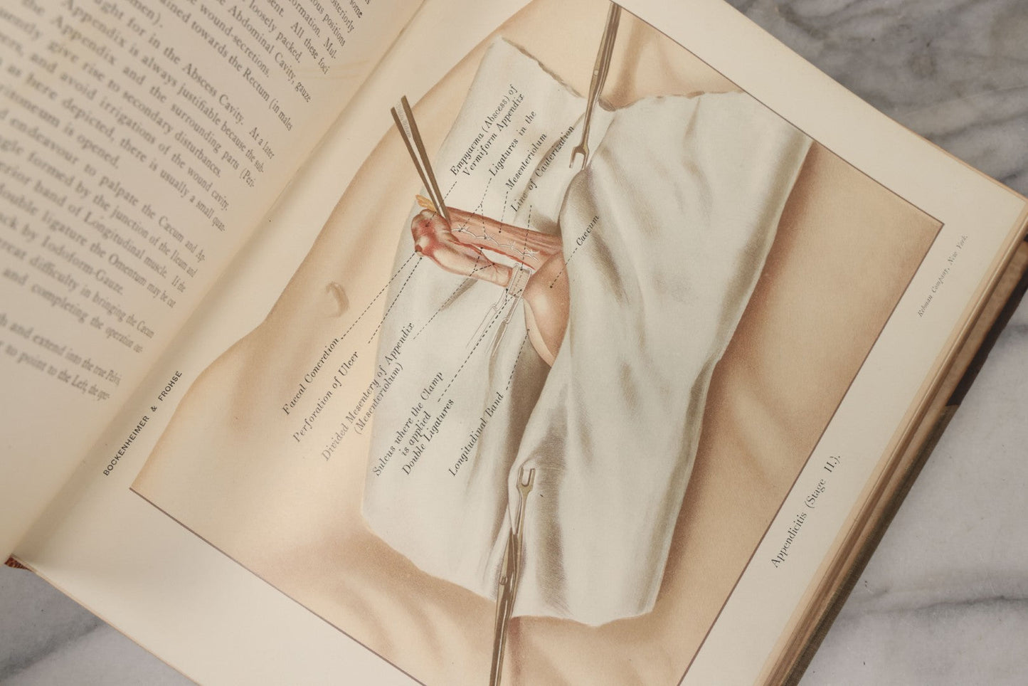 Lot 002 - "Atlas Of Typical Operations In Surgery" Antique Book By Dr. Ph. Bockenheimer & Dr. Fritz Frohse, With 60 Full Color Illustrations By Franz Frohse, English Adaptation By J. Howell Evans, Rebman Company, New York, Publishers, Circa 1900