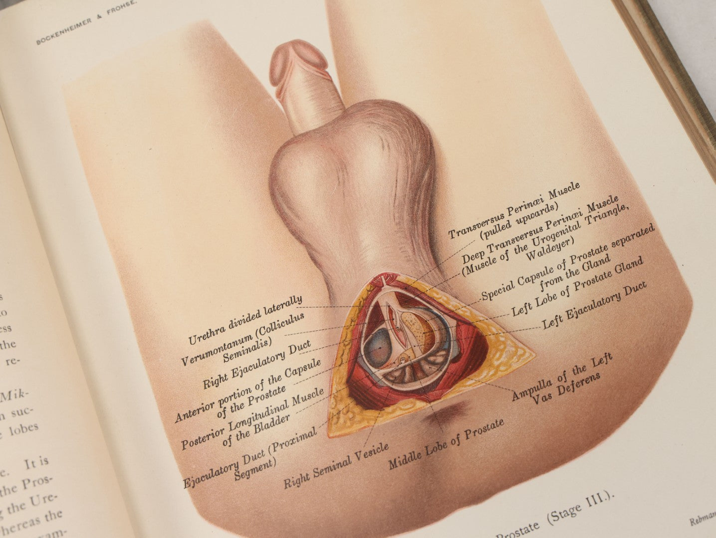 Lot 002 - "Atlas Of Typical Operations In Surgery" Antique Book By Dr. Ph. Bockenheimer & Dr. Fritz Frohse, With 60 Full Color Illustrations By Franz Frohse, English Adaptation By J. Howell Evans, Rebman Company, New York, Publishers, Circa 1900