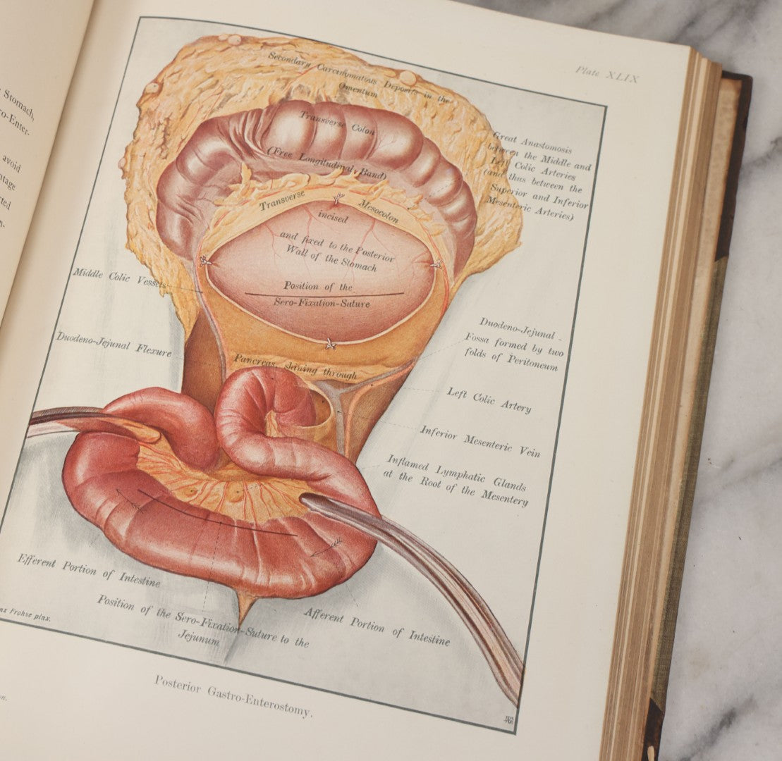 Lot 002 - "Atlas Of Typical Operations In Surgery" Antique Book By Dr. Ph. Bockenheimer & Dr. Fritz Frohse, With 60 Full Color Illustrations By Franz Frohse, English Adaptation By J. Howell Evans, Rebman Company, New York, Publishers, Circa 1900