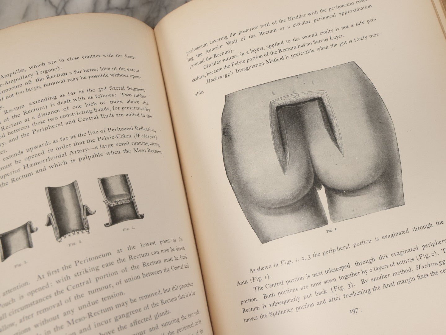 Lot 002 - "Atlas Of Typical Operations In Surgery" Antique Book By Dr. Ph. Bockenheimer & Dr. Fritz Frohse, With 60 Full Color Illustrations By Franz Frohse, English Adaptation By J. Howell Evans, Rebman Company, New York, Publishers, Circa 1900