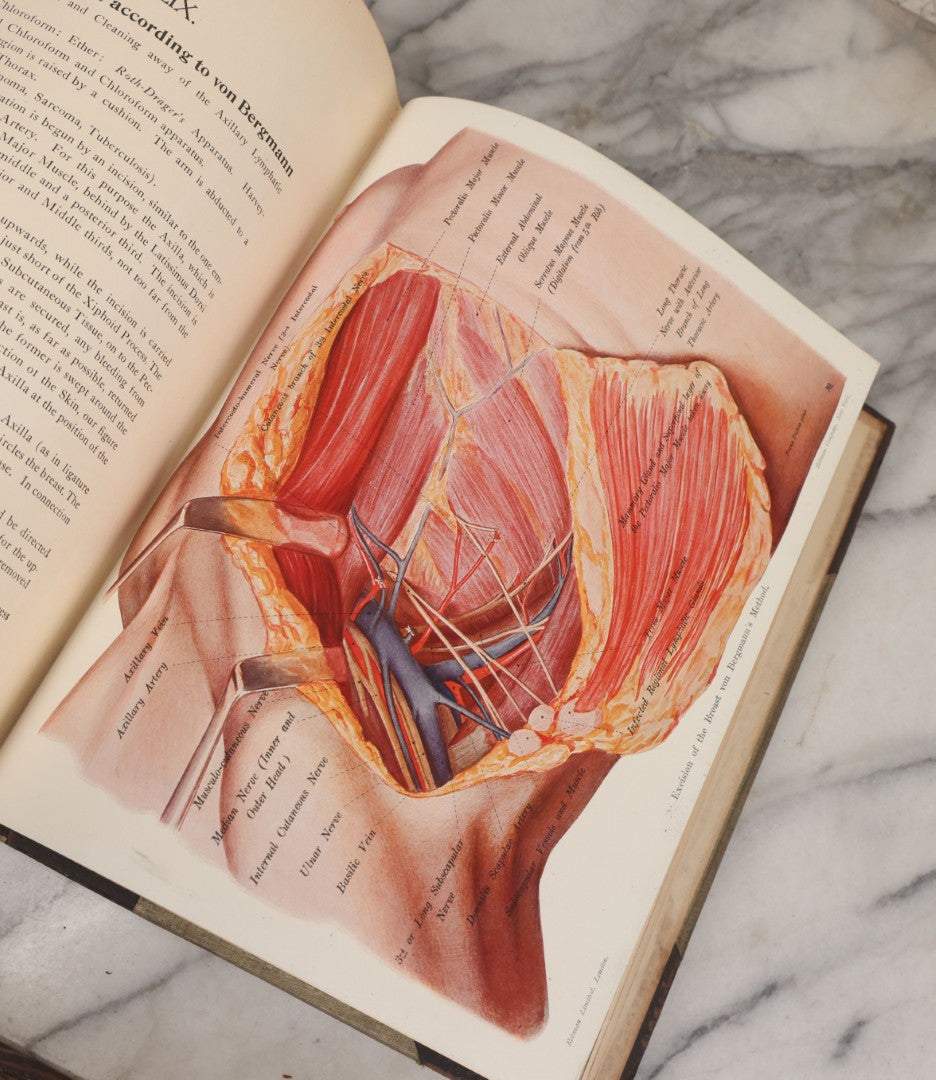 Lot 002 - "Atlas Of Typical Operations In Surgery" Antique Book By Dr. Ph. Bockenheimer & Dr. Fritz Frohse, With 60 Full Color Illustrations By Franz Frohse, English Adaptation By J. Howell Evans, Rebman Company, New York, Publishers, Circa 1900